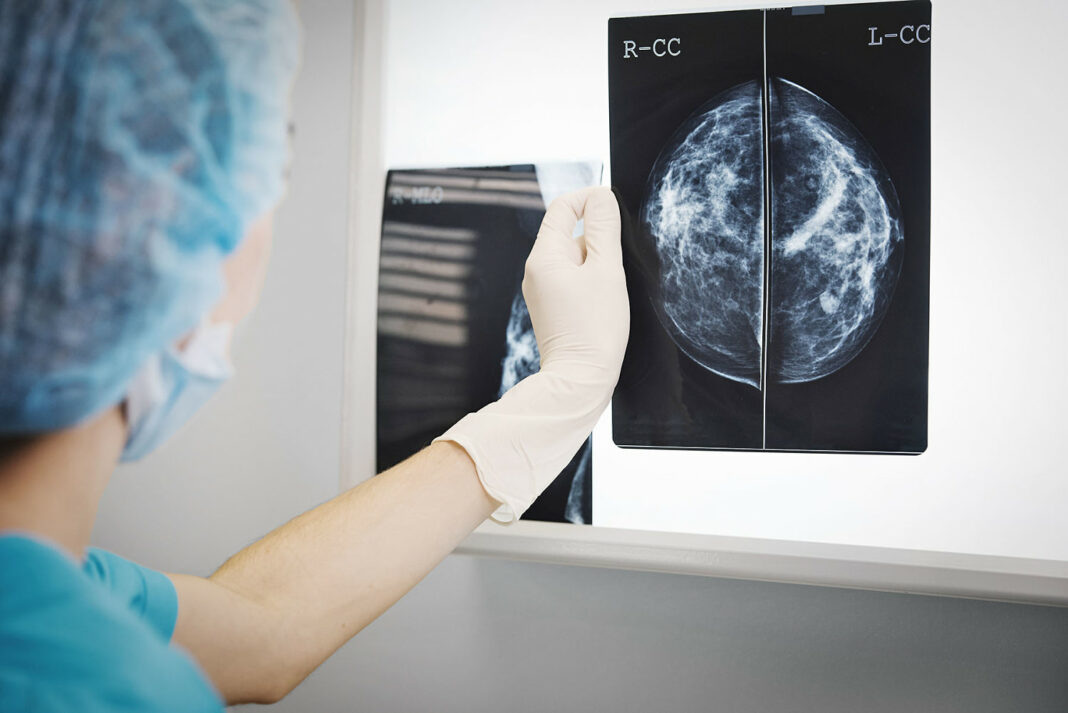 New study reveals how fat cells can fuel cancer tumors
